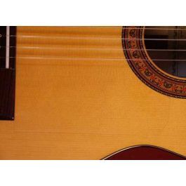 PLAQUE DE PROTECTION autocollant pièce efficace installation guitare